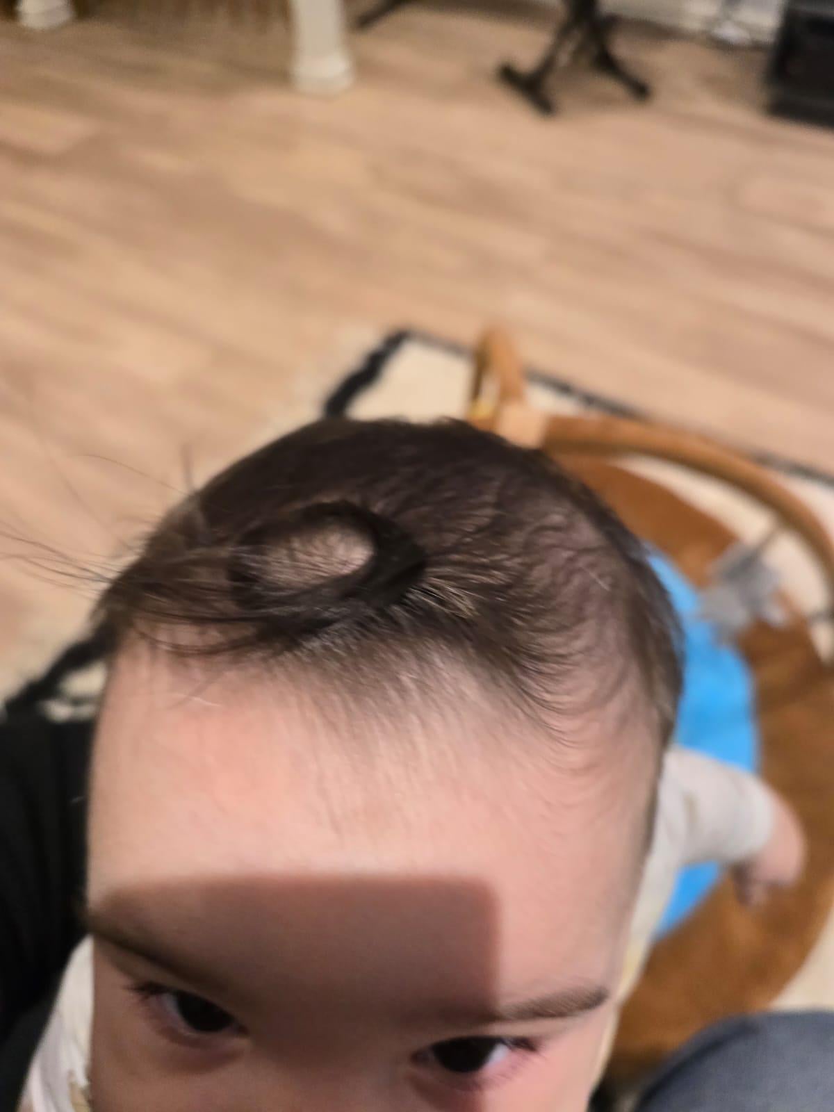 7ヶ月児のつむじ、伸びすぎ！他の子と違うの？心配…