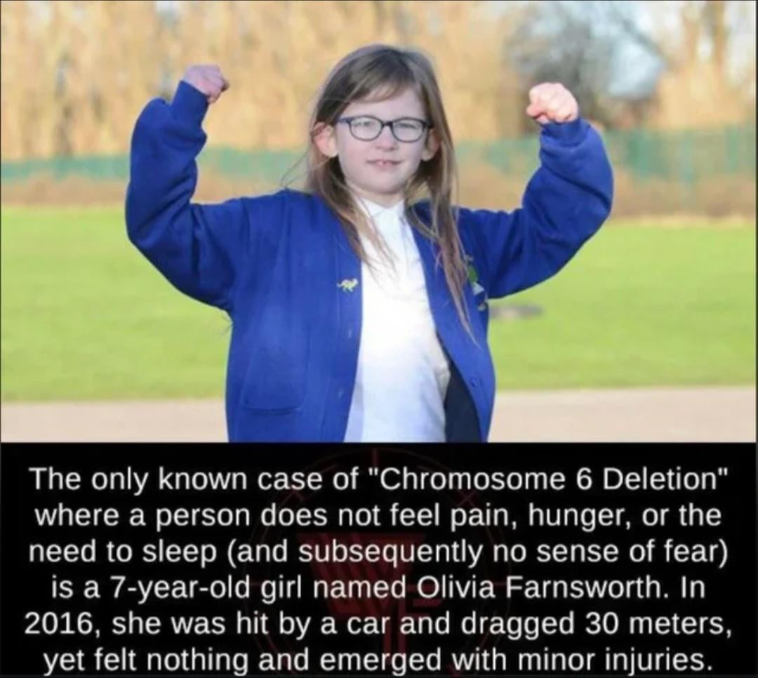 【マジか】痛覚・空腹・疲労を感じない少女、その原因が判明… bionic girl オブライア・ファーンズワース