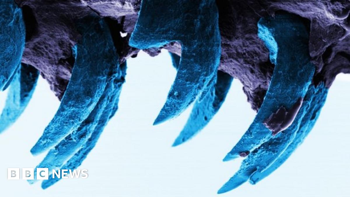 リンペットの歯が最強生物材料、クモの糸超え5ギガパスカル耐圧
