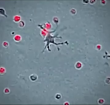 マクロファージ最強！白血球が病原体を駆逐しまくるｗｗｗｗｗｗｗ