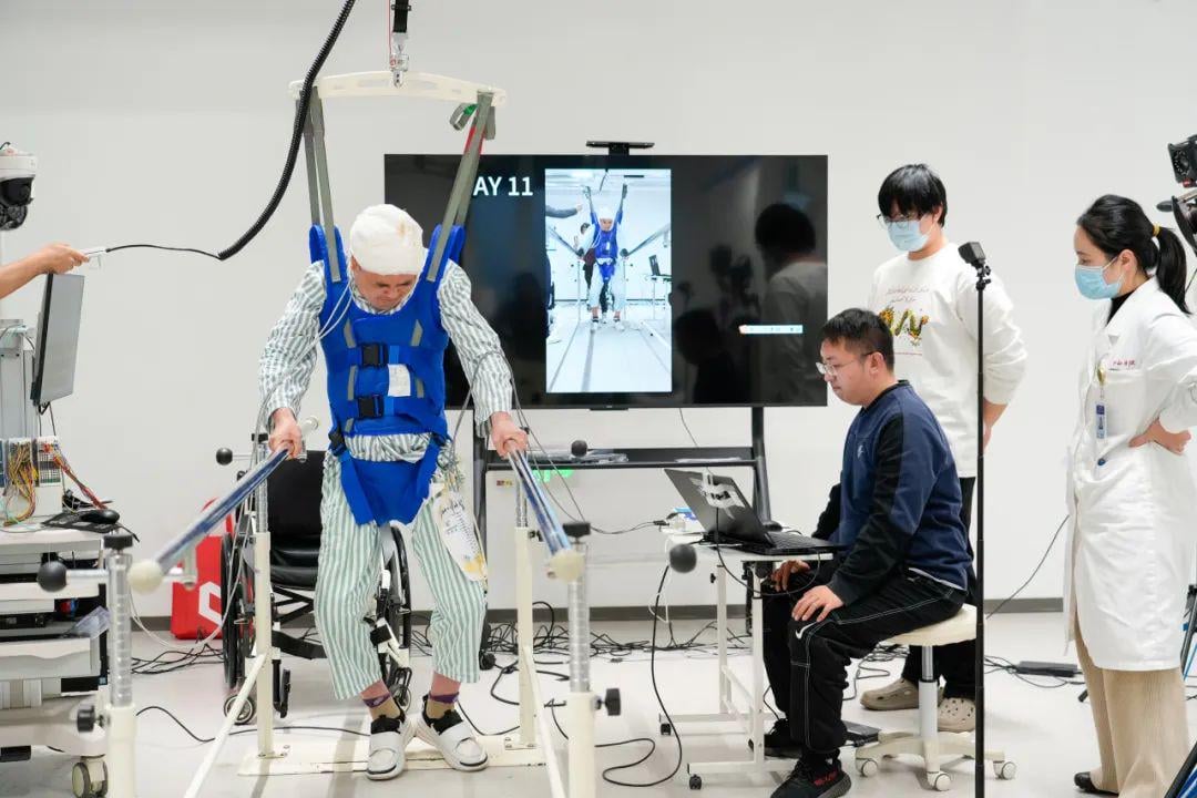 【速報】上海科学者、神経バイパス手術で麻痺患者が再び歩行可能に！