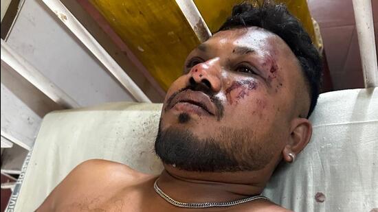 【衝撃】エアインディア墜落事故、11A席の奇跡！生還者語る