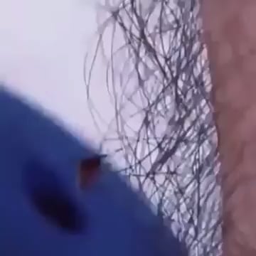 体毛はマジで蚊対策になるらしいぞｗｗｗ