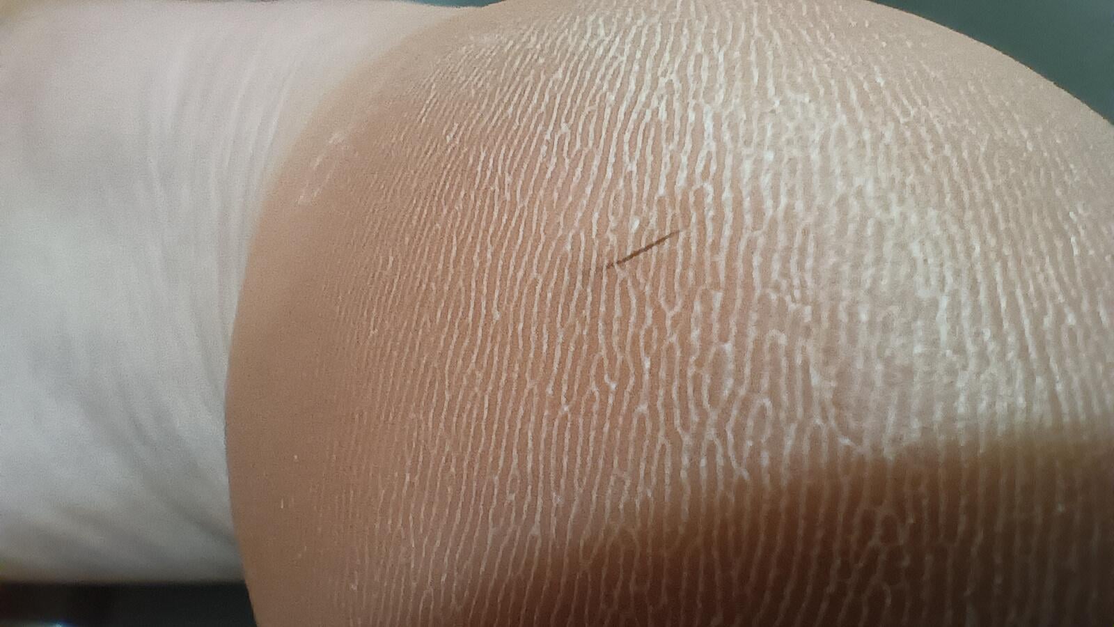 足の裏に謎の激痛…原因はまさかの〇〇だった…！