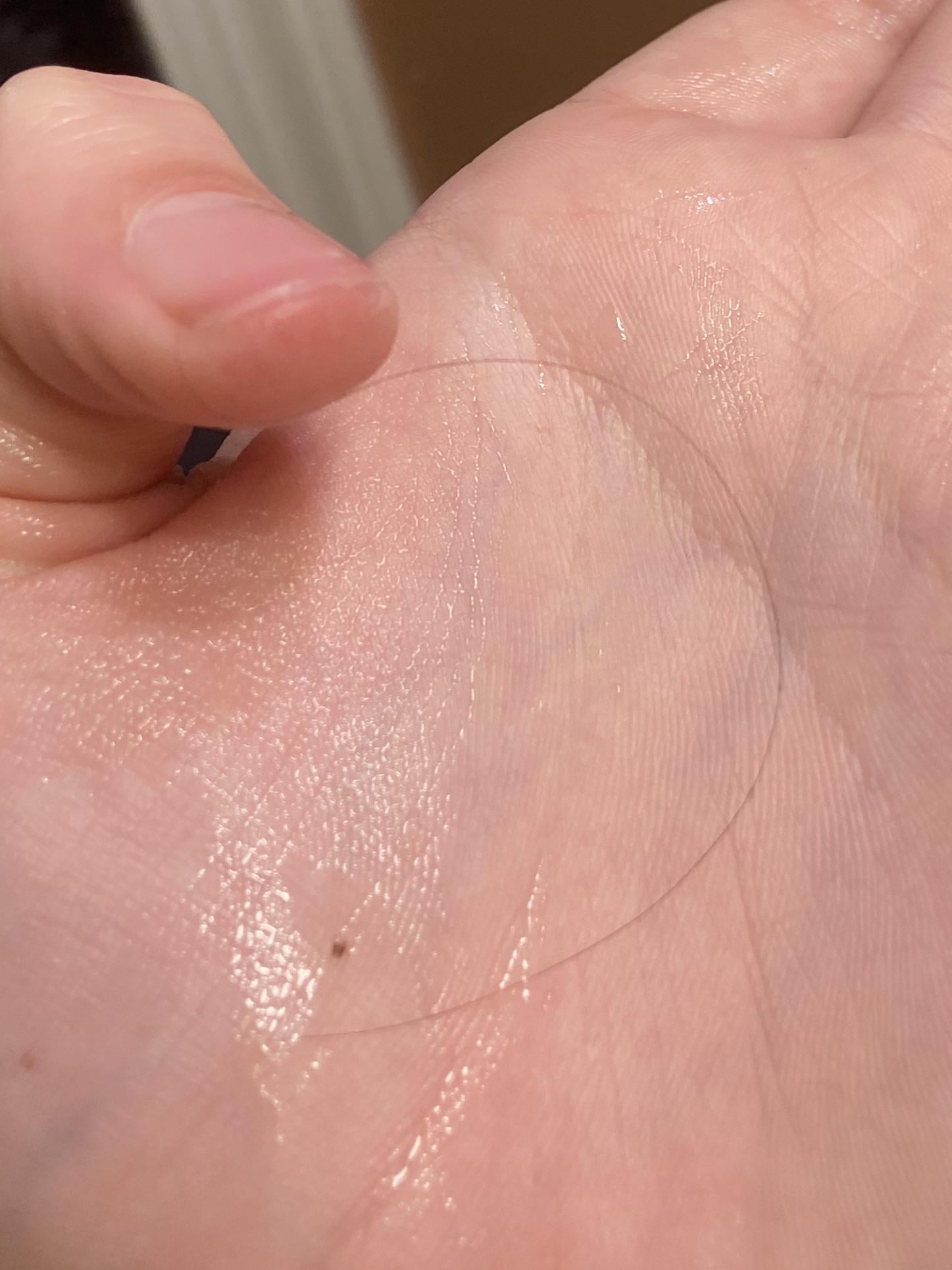 まじかよ…まつ毛じゃねぇ！自分の髪の毛が眼球に絡み付いた女性の悲劇