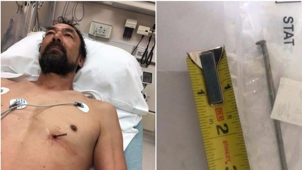 【マジかよ】DIY中に心臓に釘ブチ込んだ男、自分で運転して病院へ…