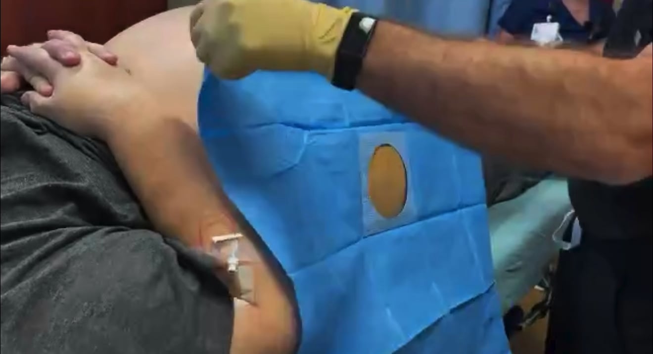 腹水19L抜いた結果ｗｗｗｗｗｗｗｗｗｗｗｗ