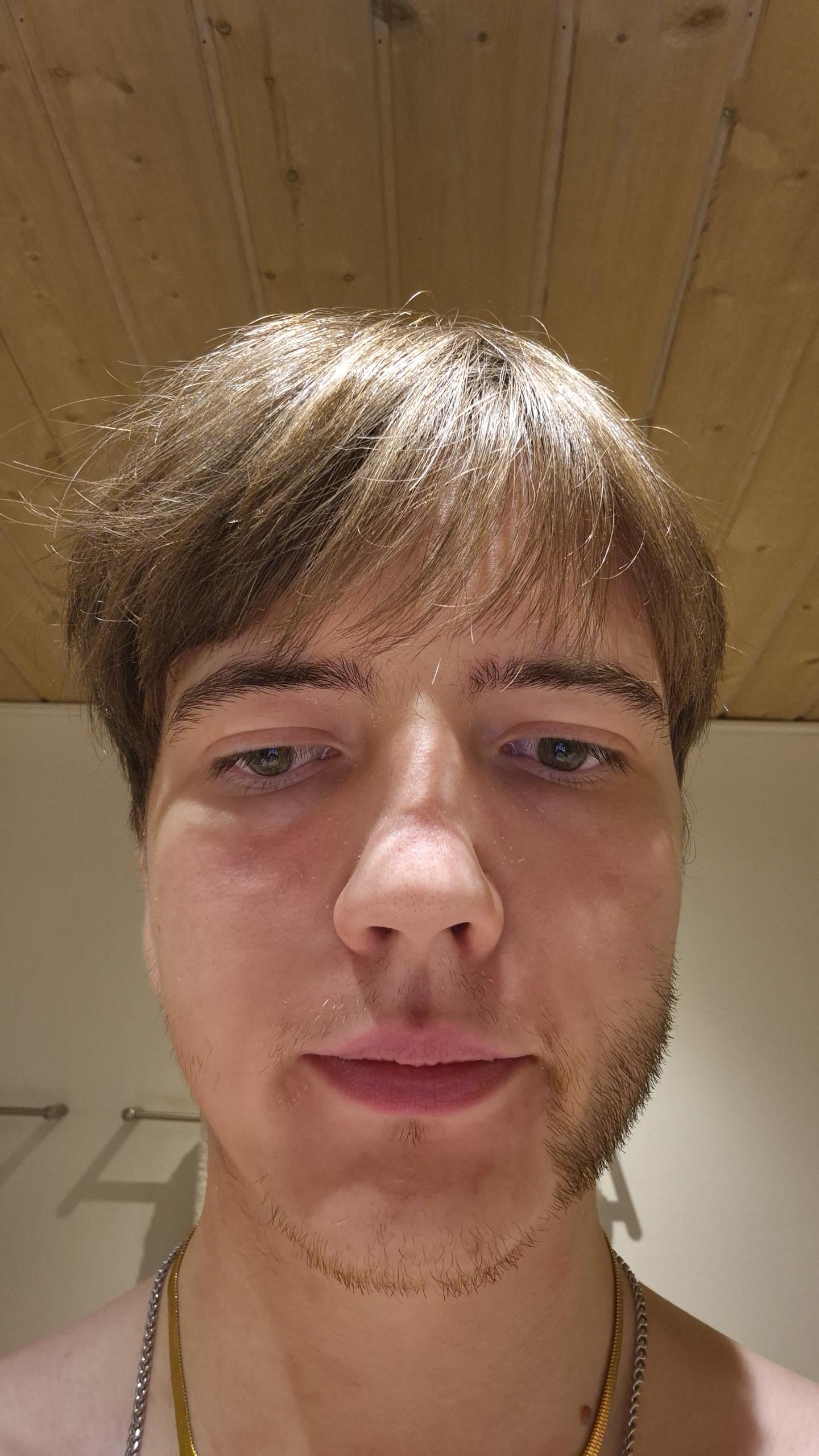 【悲報】ワイ、顔の左側だけヒゲ生えんのやが…