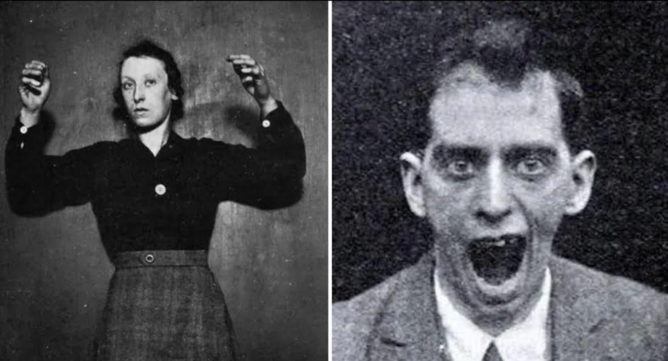 謎の昏睡性脳炎、20世紀を震撼させた病が突如消滅…原因不明のまま