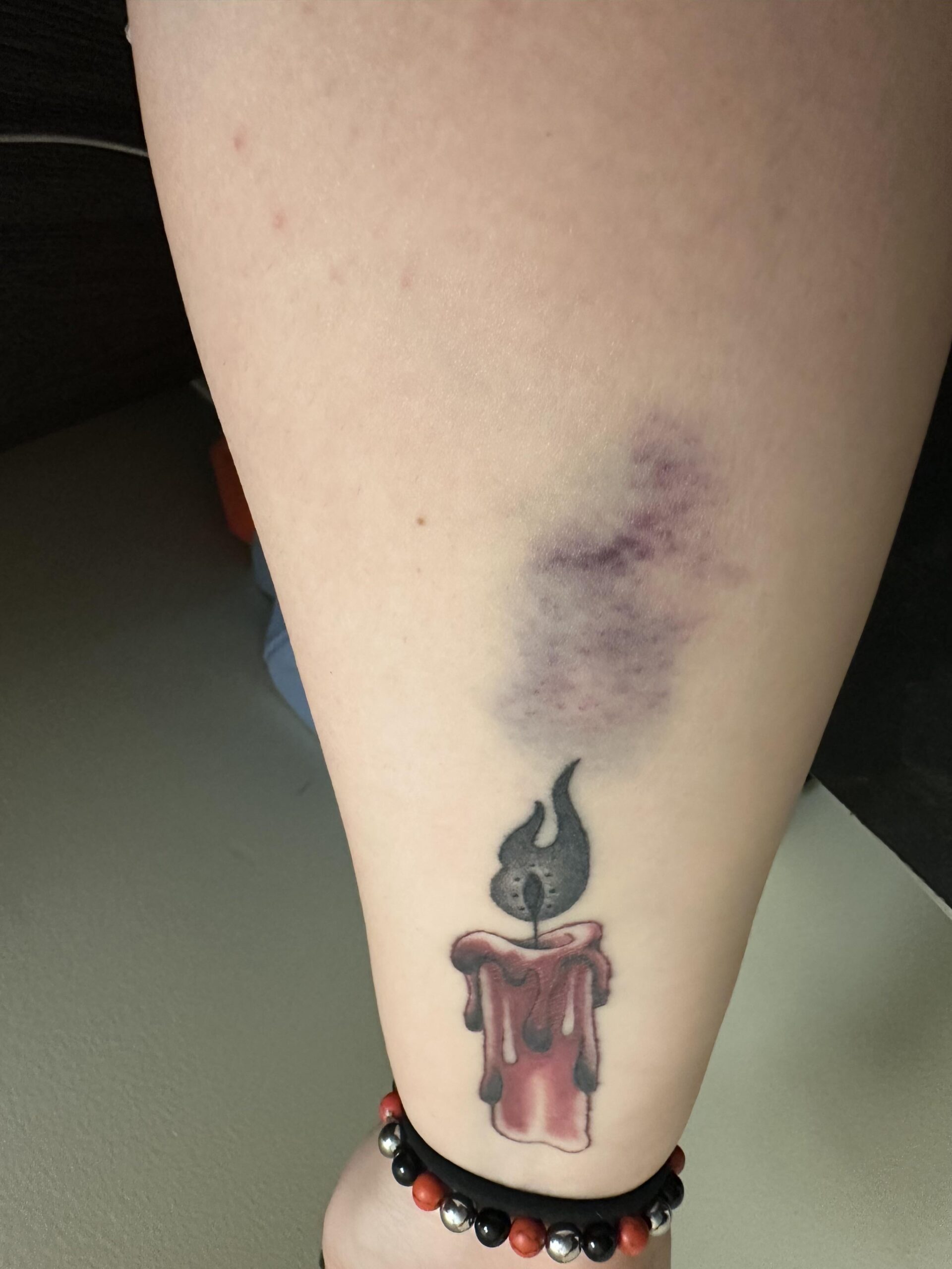 入れた覚えのないアザ、タトゥーの一部だった